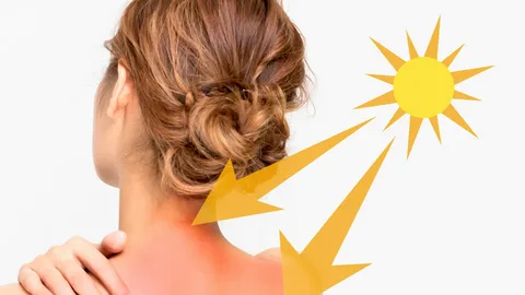 Guia prático: Alivie Queimaduras do Sol e Irritações na Pele com Bicarbonato de Sódio 1 Pele queimada do sol